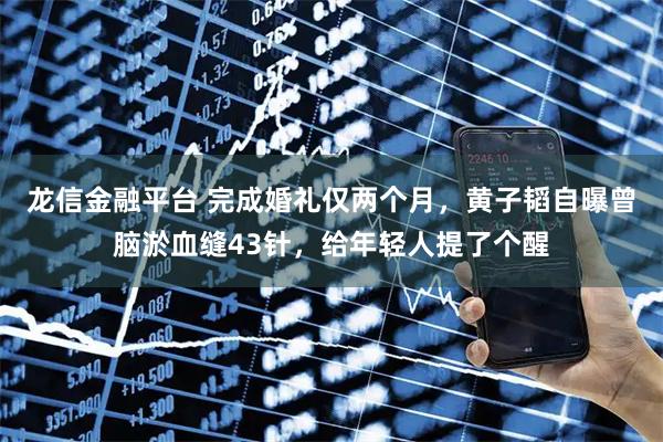 龙信金融平台 完成婚礼仅两个月,黄子韬自曝曾脑淤血缝43针,给年轻人提了个醒